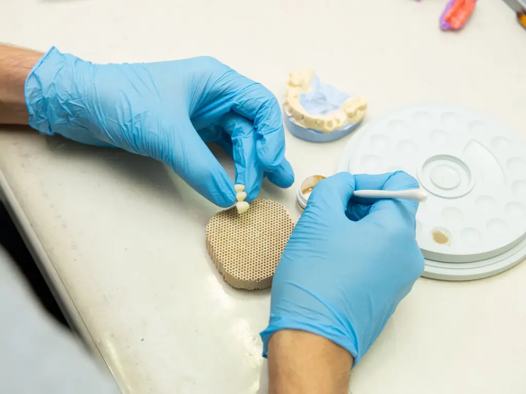 Photo illustrant : Dentisterie esthétique
